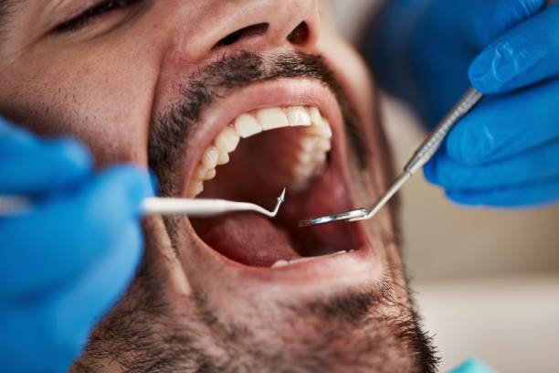 Best Dentist for Severe Toothache  in Lansing, IL