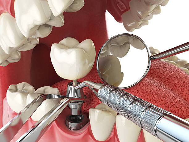 Best Root Canal Emergency Dentist  in Lansing, IL